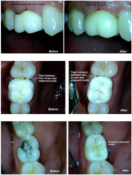 Dentist in Pimple Saudagar