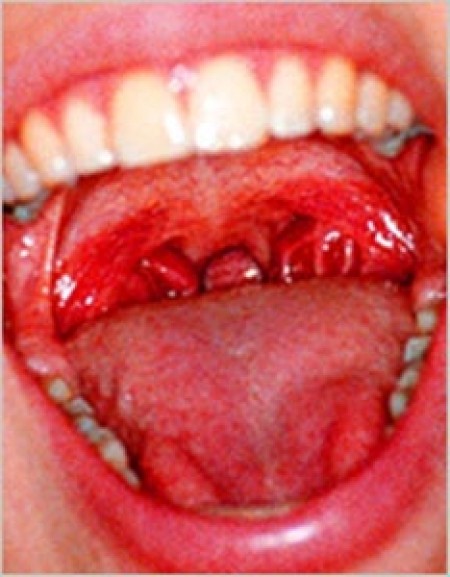 Dentist in Pimple Saudagar