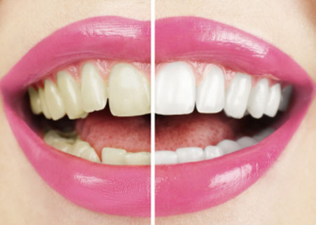 cosmetic dentist in pune