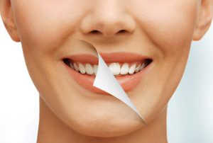 Smile Makeover Cost in India