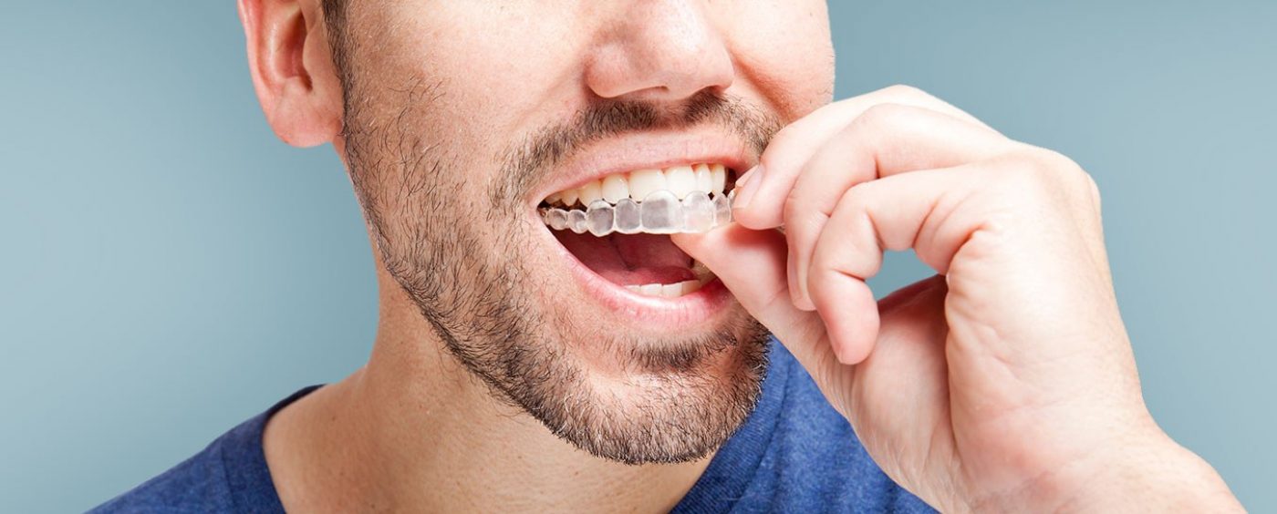 Invisalign in Pune