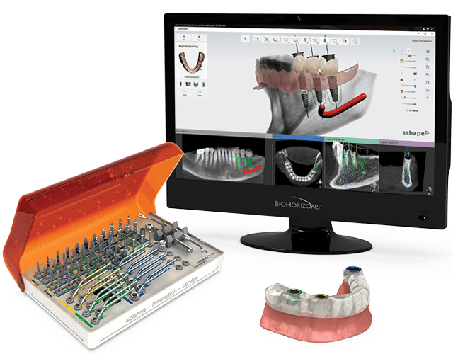 Biohorizons dental implants